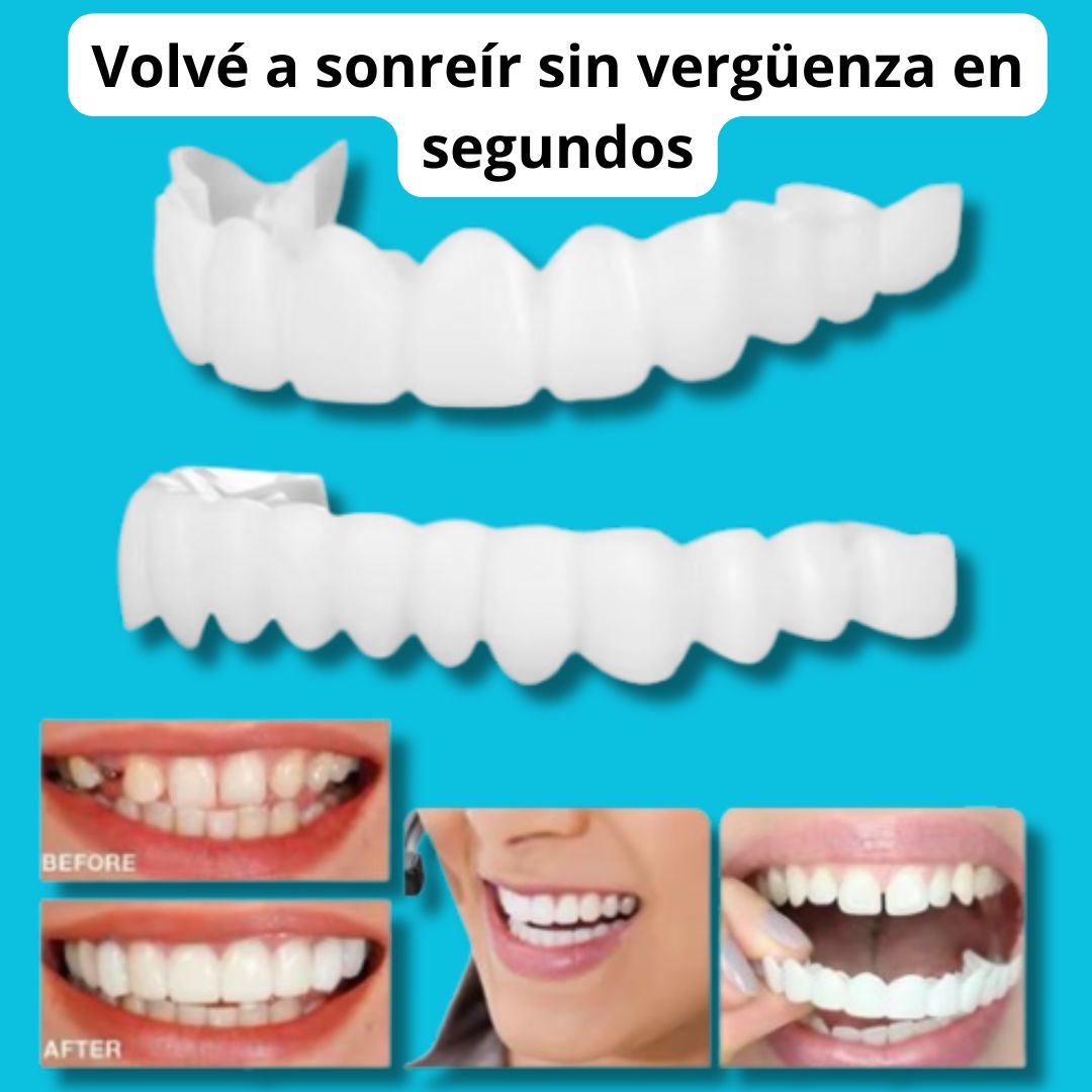 Sonriax™ – La forma más rápida de recuperar tu sonrisa