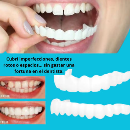Sonriax™ – La forma más rápida de recuperar tu sonrisa